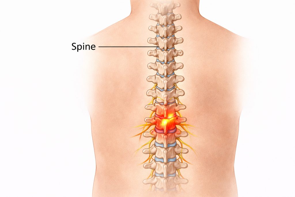 Spine anatomy showing lower back pain